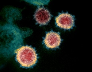 Novo coronavírus (SARS-CoV-2) por National Institute of Allergy and Infectious Diseases - NIAID. Disponível em: niaid.nih.gov/diseases-conditions/coronaviruses